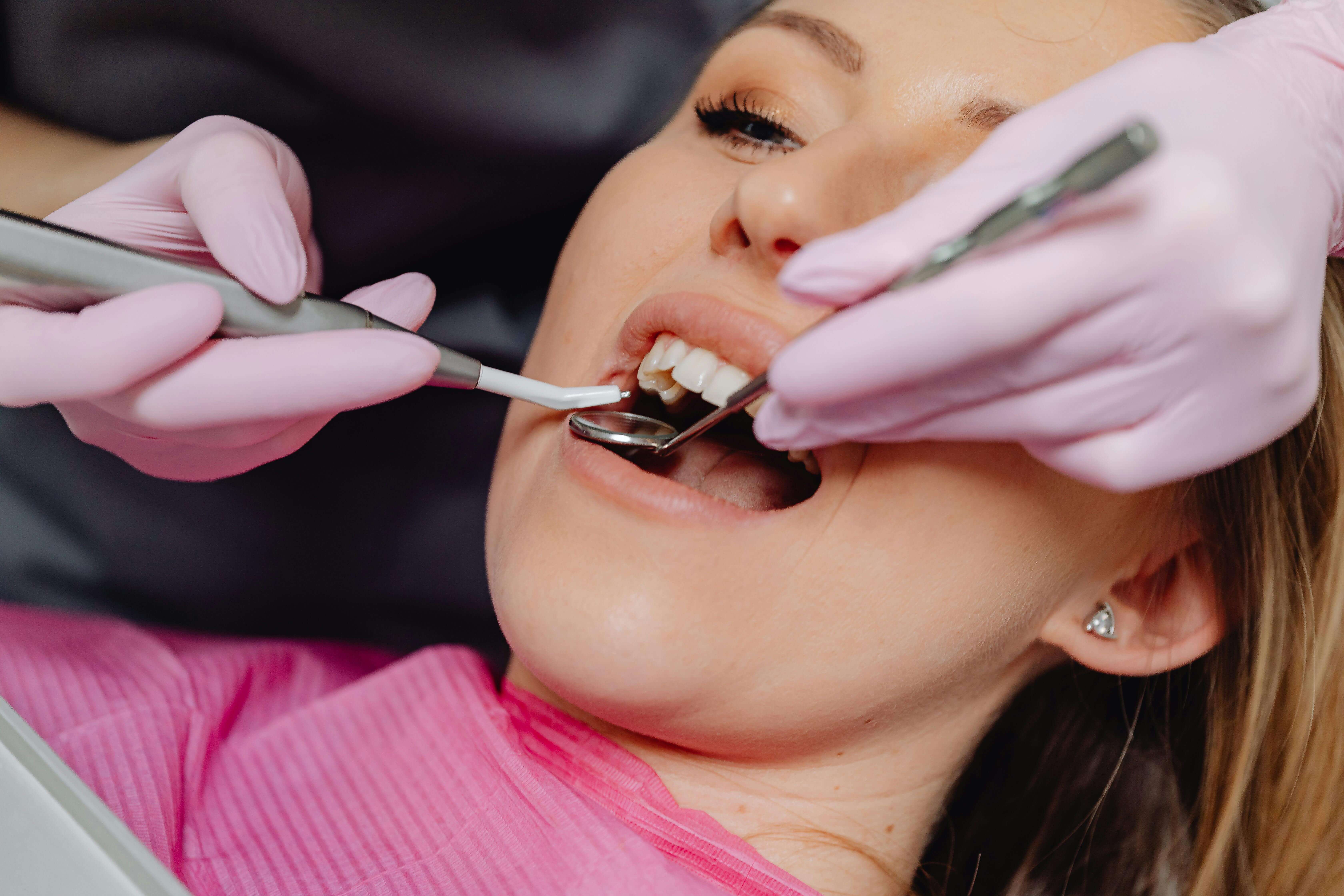 Dental Implants